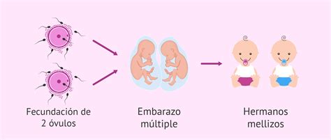 Infografía comparativa de la probabilidad de embarazo múltiple en reproducción asistida vs. natural
