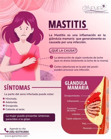 Esquema que muestra la relación entre la mastitis materna, el vaciado de la mama y el uso de antibióticos bajo prescripción médica.