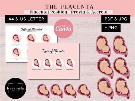 Ilustración de las diferentes posiciones de la placenta previa