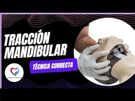 Representación gráfica de la tracción mandibular en un niño.