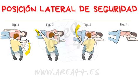 Representación gráfica de la posición lateral de seguridad en un niño.