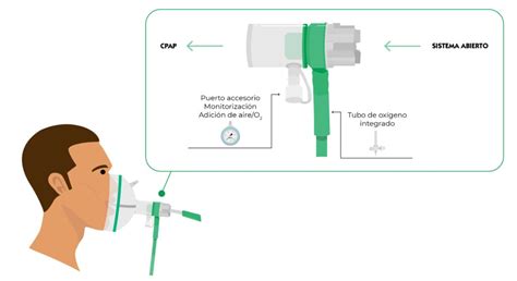 Diagrama que muestra los componentes de un sistema CPAP nasal, incluyendo mezclador de gases, humidificador, generador de presión e interfaz nasal.