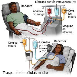 Infografía del proceso de trasplante de células madre