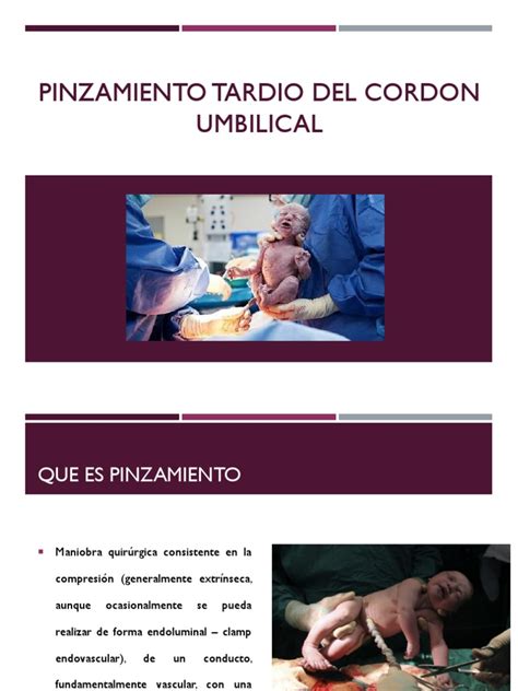 Diagrama comparativo de los beneficios del pinzamiento tardío del cordón umbilical frente al pinzamiento inmediato.