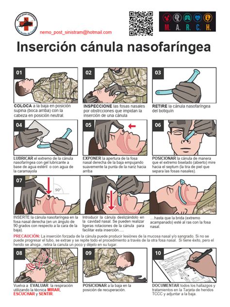 Ilustración de la colocación correcta de la cánula orofaríngea en un lactante.