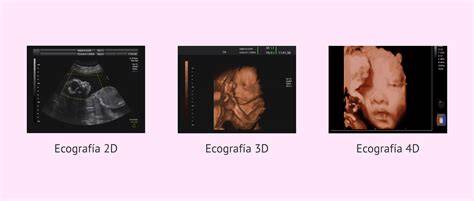 Ecografía 3D de un feto en el segundo trimestre