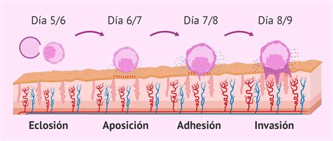 Infografía detallando las cuatro fases de la implantación: eclosión, aposición, adhesión e invasión.