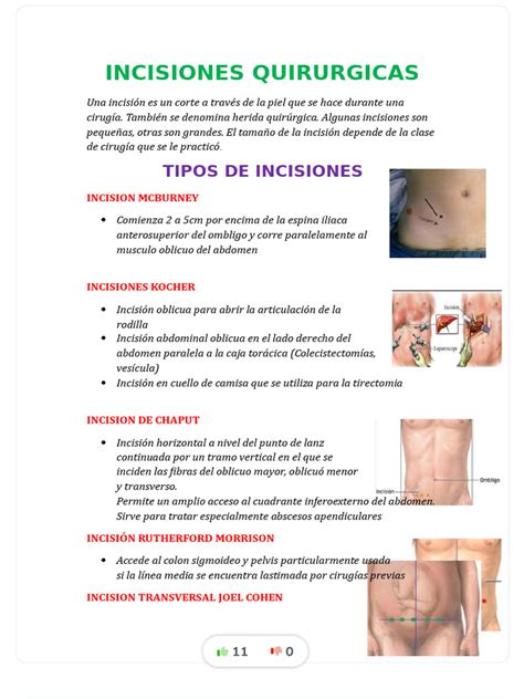 Esquema de incisiones de cesárea: vertical y horizontal, mostrando su ubicación y longitud