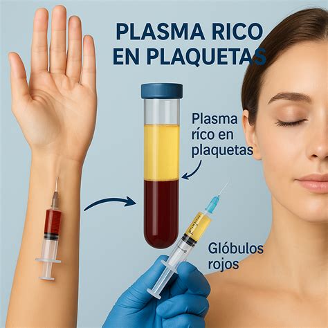 Imagen ilustrativa del proceso de aplicación de plasma rico en plaquetas en una cicatriz