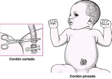 Esquema de las diferentes estrategias de manejo del cordón umbilical en el recién nacido
