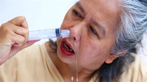 Esquema de cómo realizar un lavado nasal en un bebé con jeringa y suero fisiológico, mostrando la posición de la cabeza y la dirección del flujo