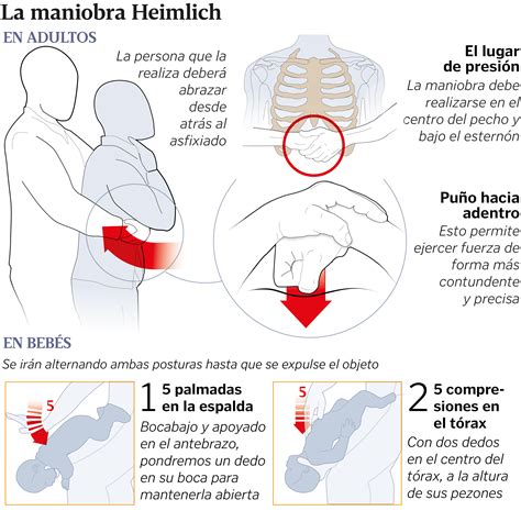 esquema detallado de la posición y puntos de presión para la maniobra de Heimlich en lactantes