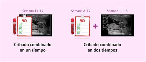 Infografía: Componentes del Cribado Combinado del Primer Trimestre