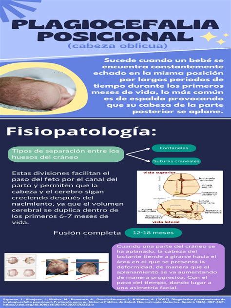 Infografía: Beneficios de las almohadas ergonómicas para bebés y prevención de plagiocefalia