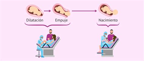 Representación gráfica de un parto natural respetado