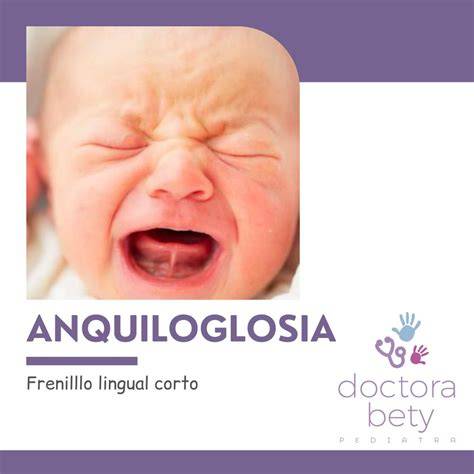Infografía que detalla los problemas asociados a la anquiloglosia: lactancia, habla y desarrollo orofacial.