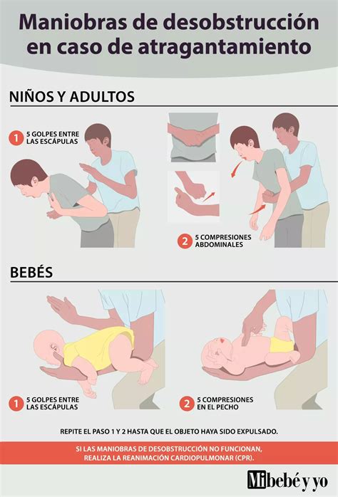 Infografía comparativa: maniobra en lactantes frente a niños y adultos.