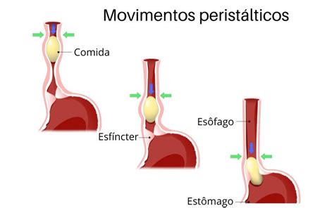 Esquema explicativo de las causas no gestacionales de movimientos abdominales (gases, peristaltismo, espasmos musculares)