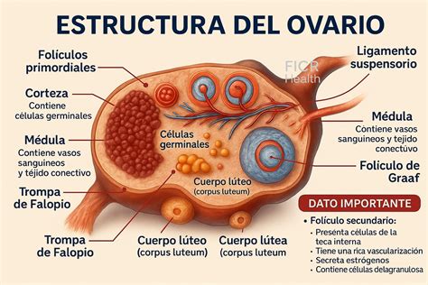 Esquema comparativo: anatomía de un ovario con quiste funcional frente a un ovario con endometrioma (quiste de chocolate).