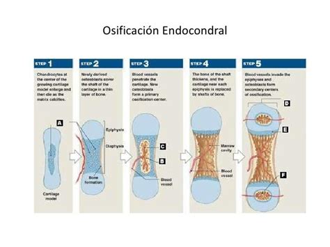 Diagrama paso a paso de la osificación intramembranosa: condensación mesenquimal, formación de espículas y desarrollo de hueso compacto.