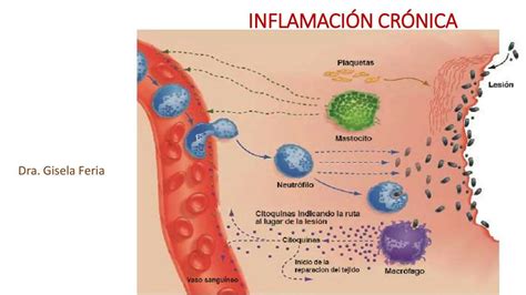 esquema detallado mostrando cómo la inflamación crónica afecta a diferentes órganos (corazón, articulaciones, piel, sistema nervioso)