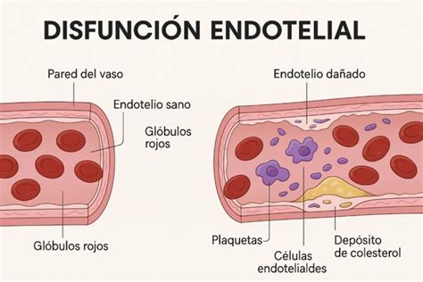 Esquema fisiopatológico: de la disfunción placentaria al daño endotelial sistémico