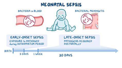 Esquema de las vías de infección y progresión de la sepsis neonatal