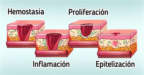 Esquema sobre las etapas de recuperación posparto y cicatrización de heridas quirúrgicas