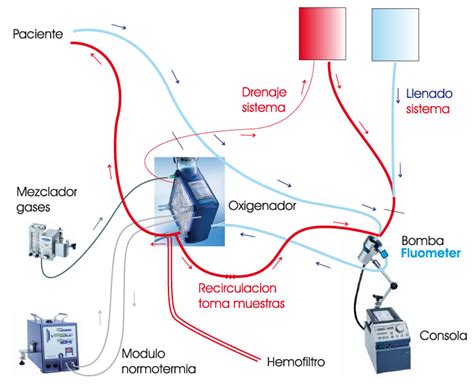 Esquema de funcionamiento de la terapia ECMO pediátrica