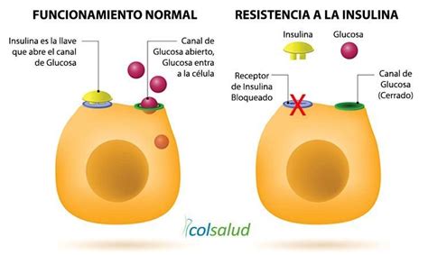 Esquema: Funcionamiento normal de la insulina vs. resistencia a la insulina en el embarazo
