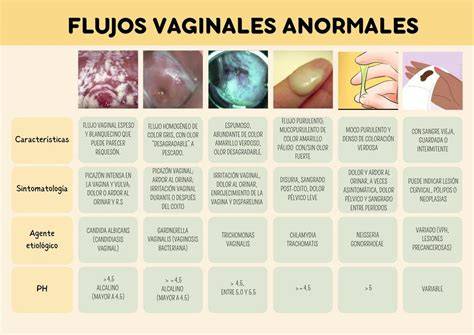 Infografía sobre los tipos de flujo vaginal normal versus anómalo