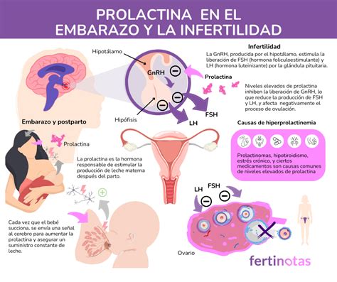Infografía sobre los niveles de prolactina y su impacto en la ovulación