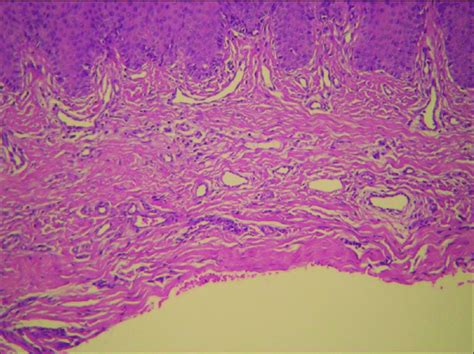 Microfotografía del corion con vasos sanguíneos