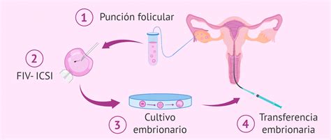 Infografía detallando los pasos del tratamiento de Fecundación In Vitro (FIV) y ICSI, incluyendo la vitrificación de gametos.