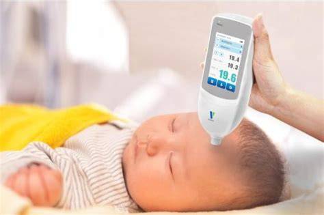 Medición de bilirrubina transcutánea en la frente de un neonato