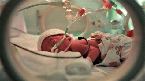 Foto de un bebé prematuro en una incubadora