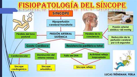Esquema de la fisiopatología del síncope vasovagal