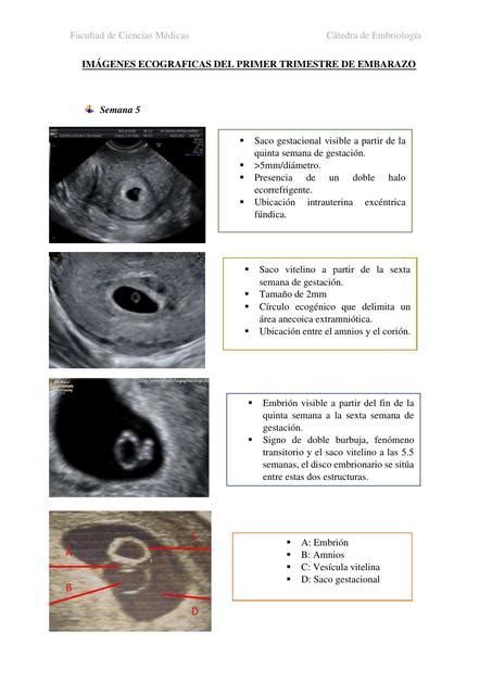 Imágenes ecográficas de la cabeza de un prematuro mostrando hiperecogenicidad periventricular