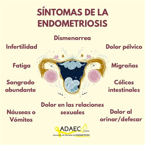Infografía sobre los síntomas de la endometritis post-legrado.