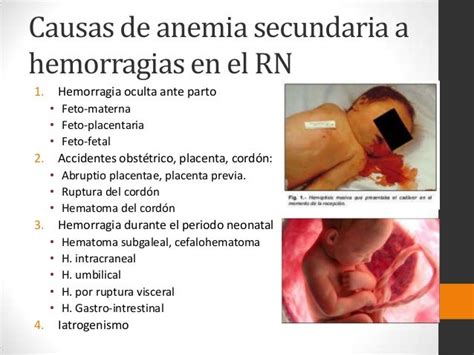 Gráfico comparativo de las tres formas de enfermedad hemorrágica del recién nacido por franjas de edad y localización de la hemorragia.