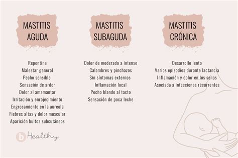 Ilustración de un conducto mamario bloqueado y signos de mastitis