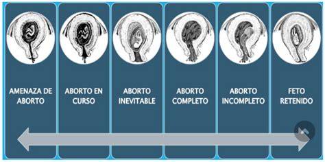 Esquema visual de las diferencias entre aborto en curso, incompleto y diferido