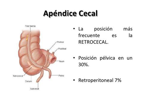 Representación anatómica del apéndice cecal y su ubicación en el intestino grueso.