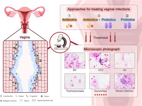 Infografía sobre la flora vaginal y la acción de los Lactobacillus