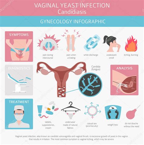 Ilustración de una infección por candidiasis vaginal con descripción de síntomas