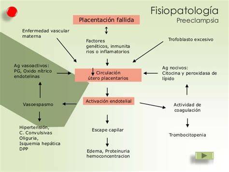 Esquema ilustrativo de la fisiopatología de la preeclampsia: insuficiencia placentaria, vasoespasmo y disfunción endotelial.
