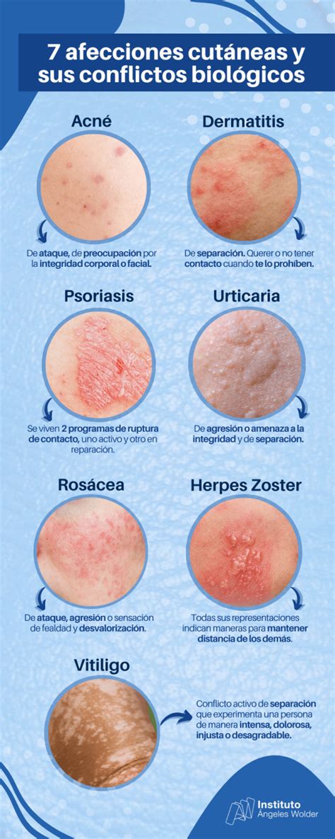 Infografía detallando las afecciones comunes de la piel del bebé y cómo tratarlas.