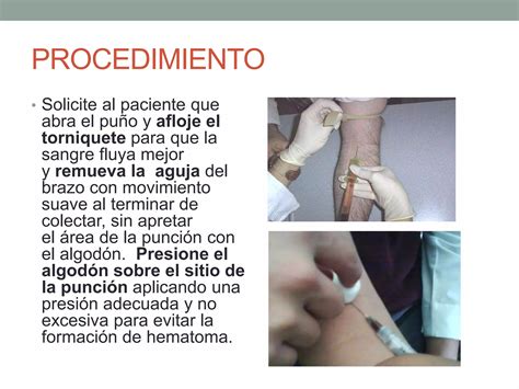 Ilustración detallada del procedimiento de punción del talón para la toma de muestra de sangre neonatal y la correcta aplicación en el papel de filtro.