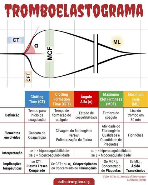 Comparativa visual entre los resultados de una tromboelastometría normal y una con coagulopatía de consumo en paciente obstétrica.