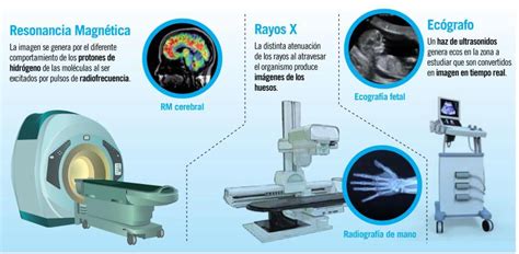 Infografía detallando los equipos de diagnóstico por imagen disponibles en el hospital, destacando la resonancia magnética.